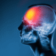 Early Warning Signs of Traumatic Brain Injury After a West Virginia Car Accident