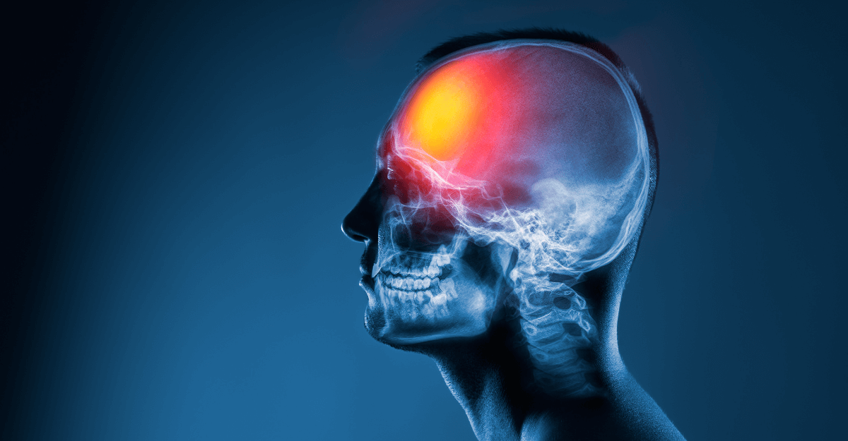 Early Warning Signs of Traumatic Brain Injury After a West Virginia Car ...